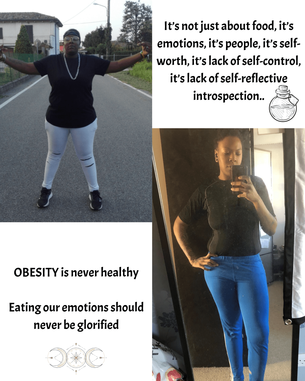 Obesity Isn’t “Body Positivity” — It’s Suffering in&nbsp;3D